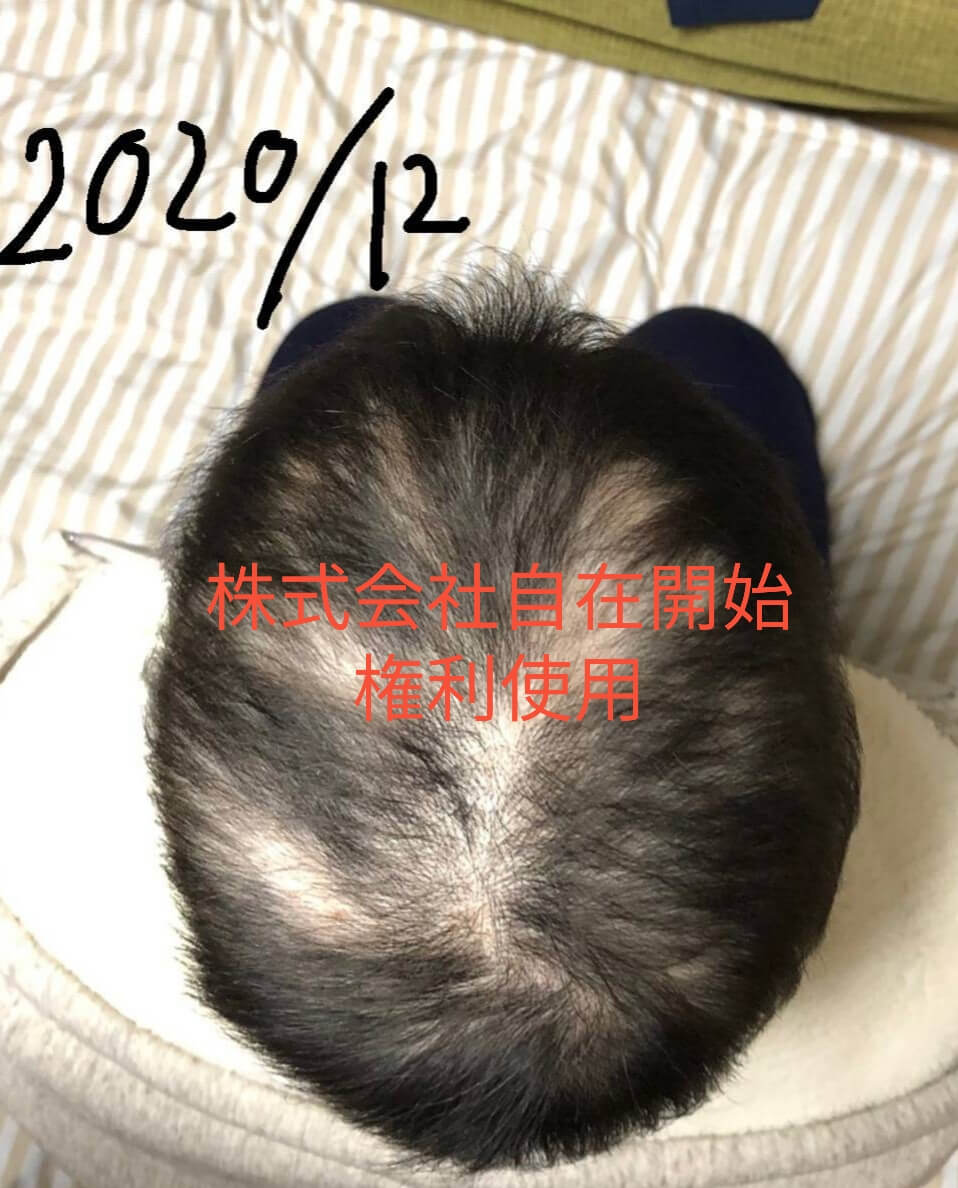 日本SuFu舒福鳳梨酵素生髮皂(日本酵母菌皂) 普通版 4